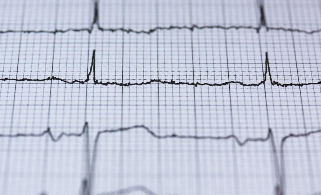 A Cardiologist describes the relationship between glucose and heart attacks, and why tracking glucose early is helpful in preventing disease.