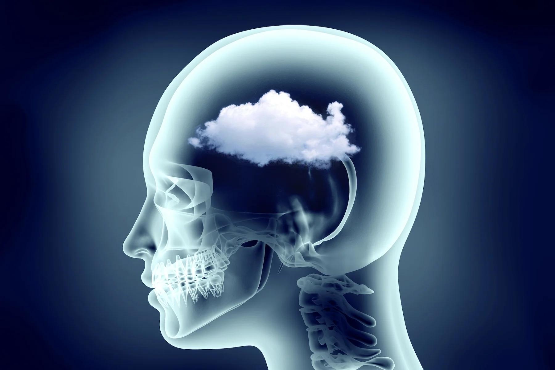 Understanding brain fog, its causes, and relation to blood sugar can help reveal why you feel more cloudy than clear-headed—and offer solutions.