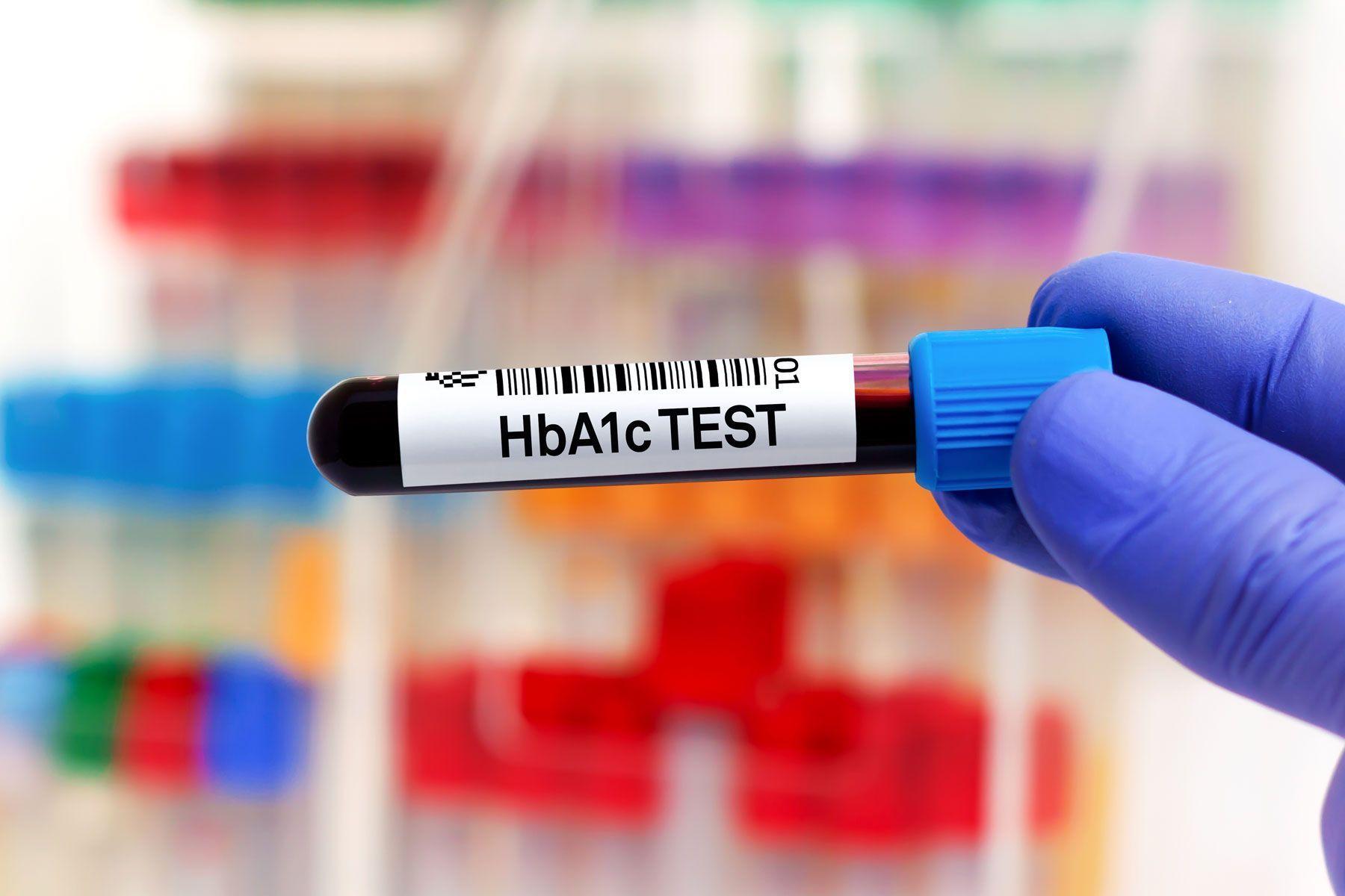 Unlike other blood sugar tests, HbA1c reflects your average glucose levels over time. Here's why it's a useful marker for minding blood sugar.