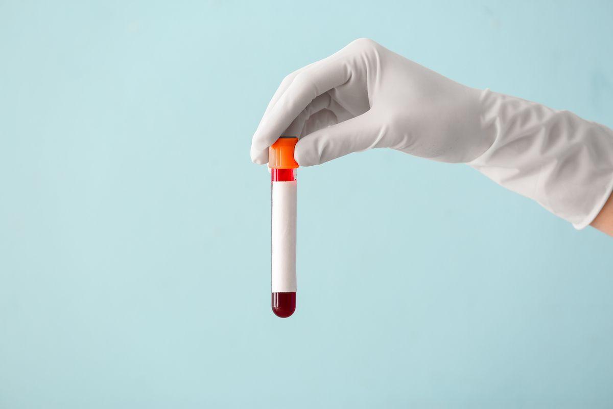 The "normal" ranges for cholesterol and other blood tests are far from optimal. We asked eight leading metabolic health experts what you should really aim for.